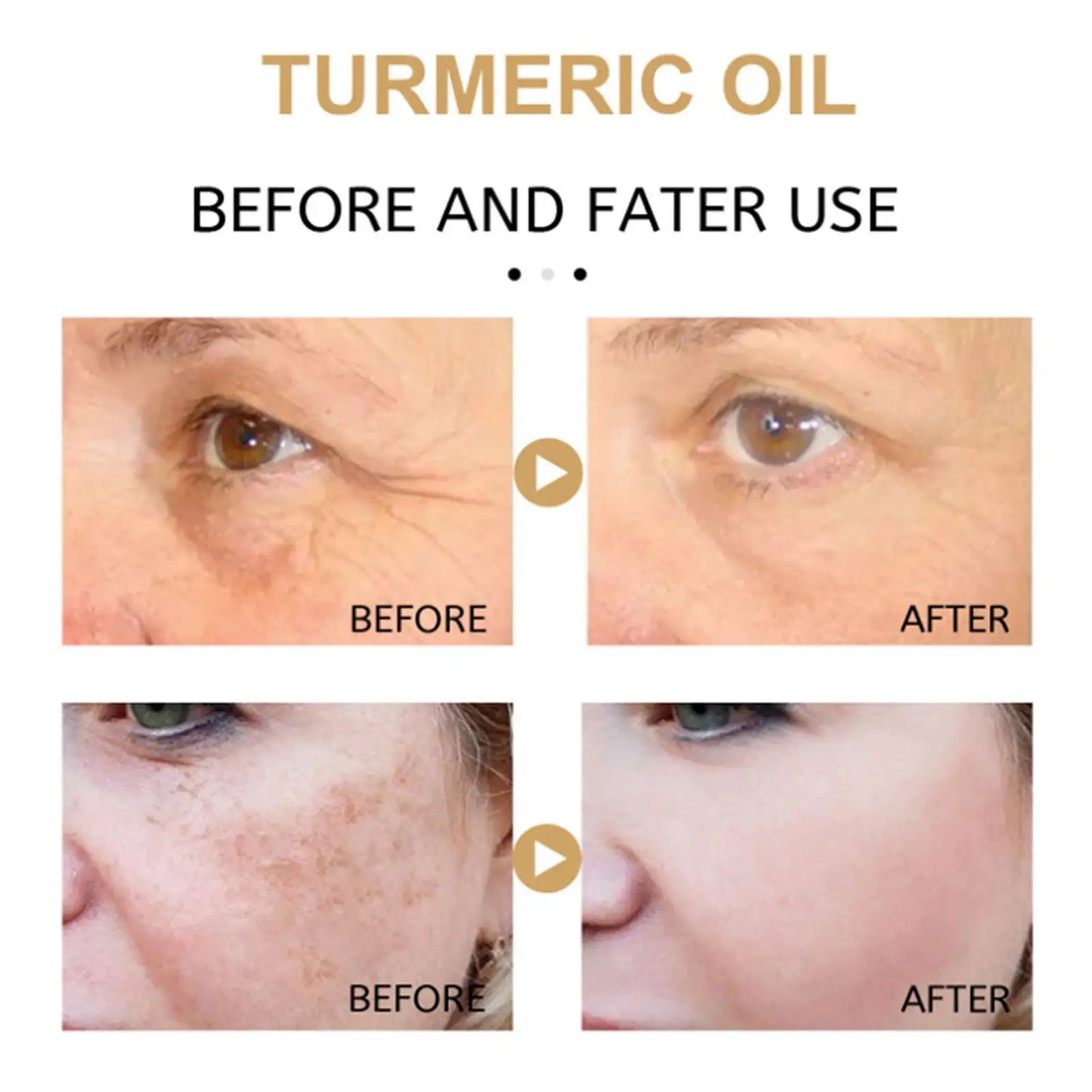 Turmeric Freckle Whitening Oil Serum Curcumin Oil Brighten Faded Dark Spot Removal Pigment Improve Roughness Skin Care