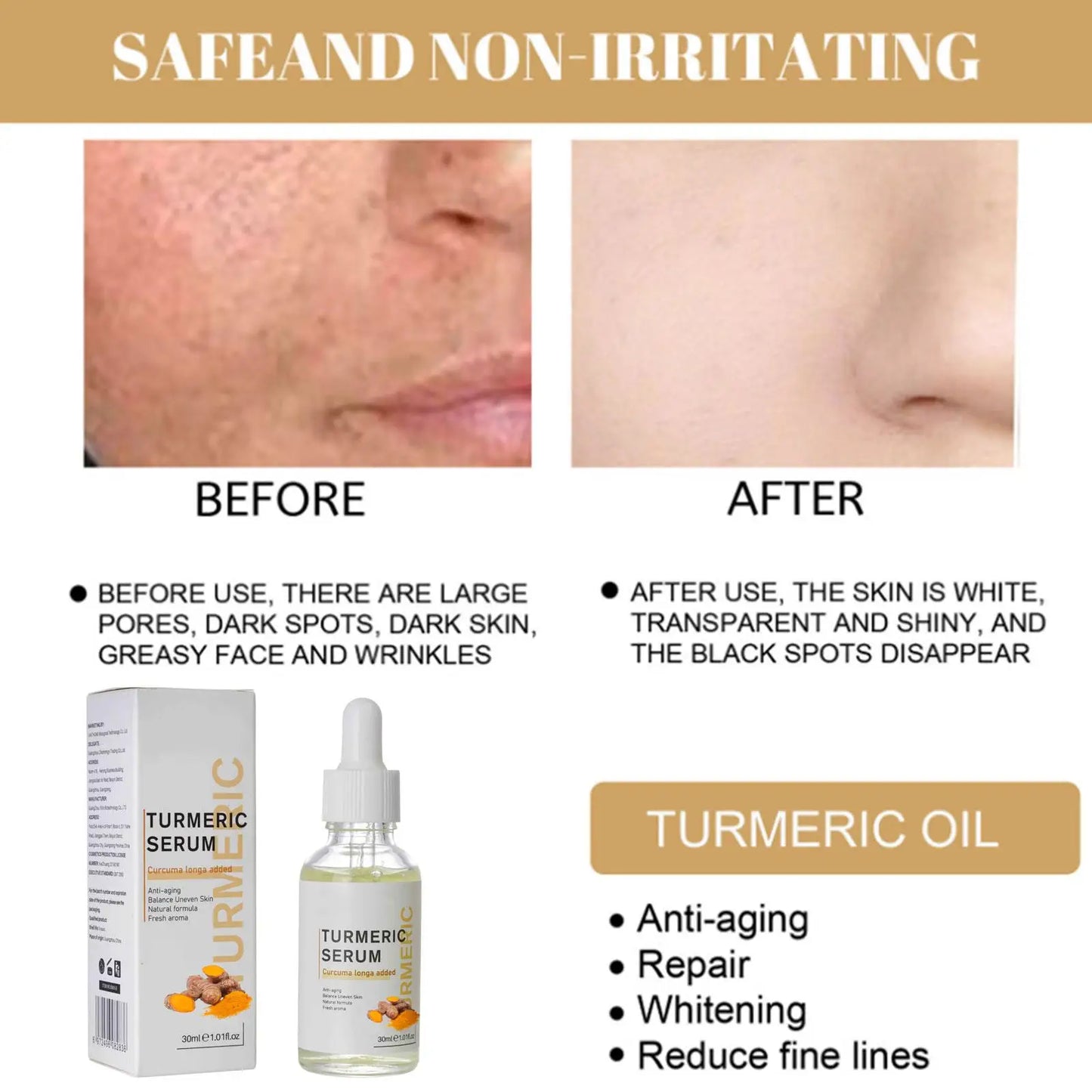 Turmeric Freckle Whitening Oil Serum Curcumin Oil Brighten Faded Dark Spot Removal Pigment Improve Roughness Skin Care